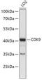 Cyclin Dependent Kinase 9 antibody, 13-314, ProSci, Western Blot image 