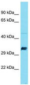 SPT7 Like, STAGA Complex Gamma Subunit antibody, TA334390, Origene, Western Blot image 