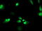 MAGE Family Member B18 antibody, M16185-1, Boster Biological Technology, Immunofluorescence image 