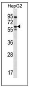Mig6 antibody, AP51460PU-N, Origene, Western Blot image 