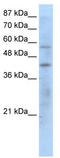 Peroxisome proliferator-activated receptor gamma antibody, TA331938, Origene, Western Blot image 