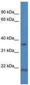Cathepsin K antibody, TA343087, Origene, Western Blot image 