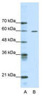 AT-Rich Interaction Domain 3A antibody, TA332067, Origene, Western Blot image 