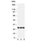 Fibroblast Growth Factor 19 antibody, R30548, NSJ Bioreagents, Western Blot image 