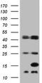 Fatty Acid Binding Protein 5 antibody, TA890007, Origene, Western Blot image 
