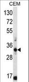 Free fatty acid receptor 1 antibody, LS-C166121, Lifespan Biosciences, Western Blot image 