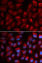 Erythrocyte Membrane Protein Band 4.1 antibody, 18-664, ProSci, Immunofluorescence image 