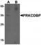 Caveolae Associated Protein 3 antibody, TA320081, Origene, Western Blot image 