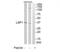 Lymphocyte-specific protein 1 antibody, TA313109, Origene, Western Blot image 