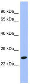 DR1 Associated Protein 1 antibody, TA329305, Origene, Western Blot image 