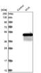 Mevalonate Kinase antibody, NBP1-82824, Novus Biologicals, Western Blot image 