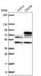 DEAD-Box Helicase 59 antibody, NBP2-13909, Novus Biologicals, Western Blot image 
