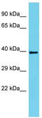 SERTA Domain Containing 4 antibody, TA330699, Origene, Western Blot image 