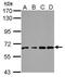 VPS33B Late Endosome And Lysosome Associated antibody, PA5-29139, Invitrogen Antibodies, Western Blot image 