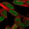 Structural maintenance of chromosomes protein 6 antibody, HPA035057, Atlas Antibodies, Immunofluorescence image 