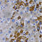 Cytochrome P450 Family 24 Subfamily A Member 1 antibody, A1805, ABclonal Technology, Immunohistochemistry paraffin image 