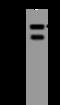 Epidermal Growth Factor Receptor Pathway Substrate 15 antibody, 200283-T44, Sino Biological, Western Blot image 