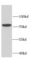 RUN And FYVE Domain Containing 2 antibody, FNab07529, FineTest, Western Blot image 