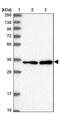 Regulation Of Nuclear Pre-MRNA Domain Containing 1A antibody, PA5-59219, Invitrogen Antibodies, Western Blot image 
