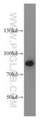 ATR Interacting Protein antibody, 11327-1-AP, Proteintech Group, Western Blot image 
