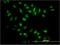 Nuclear Receptor Subfamily 0 Group B Member 1 antibody, H00000190-M03, Novus Biologicals, Immunofluorescence image 