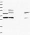 EF-Hand And Coiled-Coil Domain Containing 1 antibody, NBP2-14450, Novus Biologicals, Western Blot image 