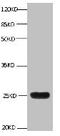 Lipocalin 2 antibody, LS-B10624, Lifespan Biosciences, Western Blot image 