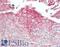 Periplakin antibody, LS-B13995, Lifespan Biosciences, Immunohistochemistry paraffin image 