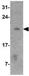 COMM Domain Containing 7 antibody, GTX31559, GeneTex, Western Blot image 