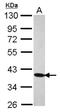 Cilia And Flagella Associated Protein 410 antibody, NBP2-21571, Novus Biologicals, Western Blot image 