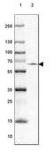 LDL Receptor Related Protein 2 antibody, NBP1-85292, Novus Biologicals, Western Blot image 