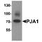 Praja Ring Finger Ubiquitin Ligase 1 antibody, TA349130, Origene, Western Blot image 