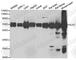 Dihydrolipoamide S-Acetyltransferase antibody, A6288, ABclonal Technology, Western Blot image 
