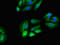 Ribosomal Protein S5 antibody, LS-C679358, Lifespan Biosciences, Immunofluorescence image 