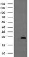 Ubiquitin Conjugating Enzyme E2 E3 antibody, TA504682S, Origene, Western Blot image 