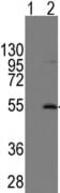 Endogenous Retrovirus Group 3 Member 1, Envelope antibody, ab71115, Abcam, Western Blot image 