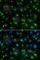 Golgi Associated, Gamma Adaptin Ear Containing, ARF Binding Protein 2 antibody, A1186, ABclonal Technology, Immunofluorescence image 