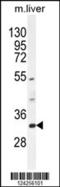 Family With Sequence Similarity 78 Member B antibody, 55-345, ProSci, Western Blot image 
