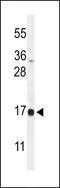 DAZ Associated Protein 2 antibody, 64-216, ProSci, Western Blot image 