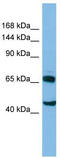 Cytoplasmic Linker Associated Protein 2 antibody, TA334068, Origene, Western Blot image 