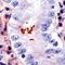 Helicobacter pylori antibody, PA5-16813, Invitrogen Antibodies, Immunohistochemistry frozen image 