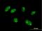 Katanin Catalytic Subunit A1 Like 2 antibody, H00083473-B01P, Novus Biologicals, Immunofluorescence image 