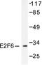 E2F Transcription Factor 6 antibody, LS-C175996, Lifespan Biosciences, Western Blot image 