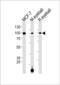 Collagen alpha-1(IX) chain antibody, MBS9209234, MyBioSource, Western Blot image 