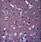 Zinc Finger SWIM-Type Containing 5 antibody, LS-C160975, Lifespan Biosciences, Immunohistochemistry paraffin image 