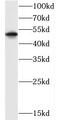 CXCR1 antibody, FNab02099, FineTest, Western Blot image 