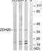 Zinc Finger DHHC-Type Containing 20 antibody, LS-B9855, Lifespan Biosciences, Western Blot image 
