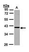 Ankyrin Repeat And SOCS Box Containing 4 antibody, orb69864, Biorbyt, Western Blot image 