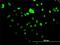 Autoantigen NOR-90 antibody, H00007343-M02, Novus Biologicals, Immunocytochemistry image 