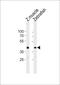 Protein L-Myc-1a antibody, PA5-72665, Invitrogen Antibodies, Western Blot image 